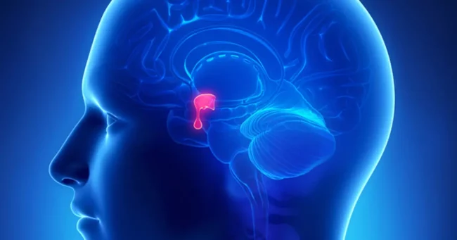Pituitary Tumor